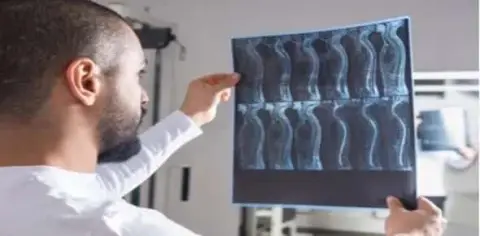 A person, potentially a lawyer specializing in spinal cord injury cases, carefully examines X-ray images held up against the light, possibly analyzing evidence for a Detroit car accident claim.